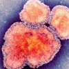 Характеристика заболевания чума холера оспа